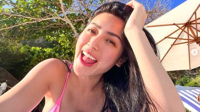 Kondisi Terkini Jessica Iskandar usai Terpapar Hepatitis A, Mengkhawatirkan!