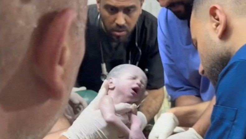 Bayi Gaza yang Lahir dari Rahim Ibu Tewas akibat Serangan Israel Meninggal Dunia