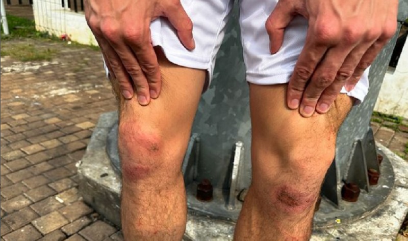 Lutut Thom Haye Luka-Luka usai Selebrasi Gol Vs Filipina, Rumput SUGBK Dikritik