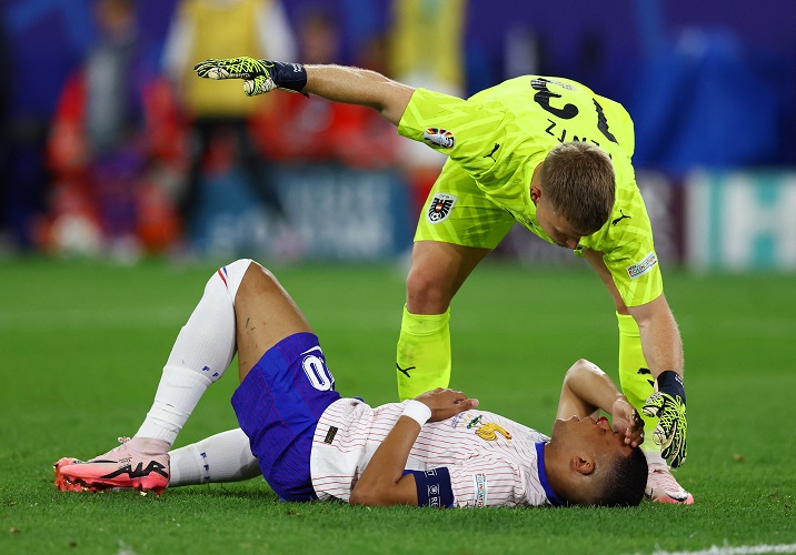 Euro 2024: Kylian Mbappe Cedera Patah Tulang Hidung, Kabar Buruk untuk Timnas Prancis 