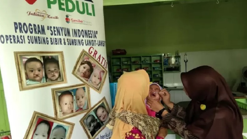 Kisah Balita dari Keluarga Sederhana Dapat Bantuan Operasi Bibir Sumbing Gratis MNC Peduli