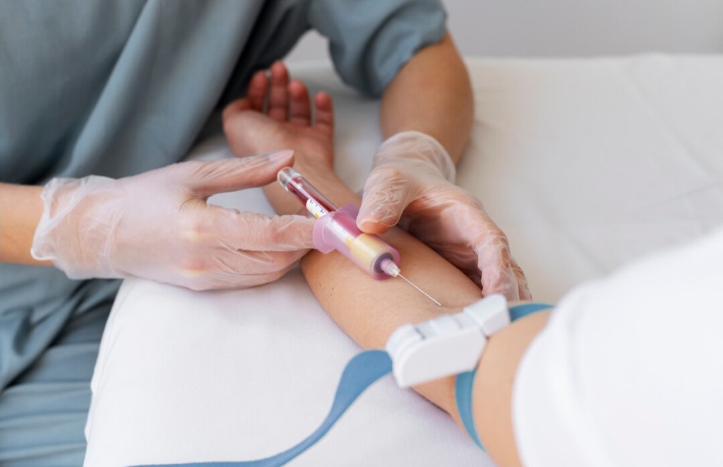 Pemerintah Jamin Biaya Pasien Cuci Darah BPJS Nonaktif? Ini Kata Wamenkes!