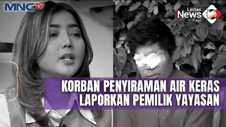 Saksikan AB+ Malam Ini: Polemik Donasi Korban Air Keras, Uang Disalahgunakan?