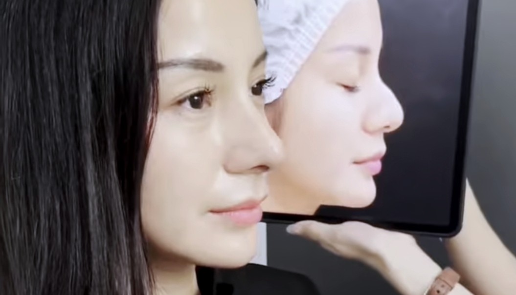 Kirana Larasati Akui Lakukan Oplas Hidung agar Lebih Cantik, Bukan di Korea tapi Thailand 