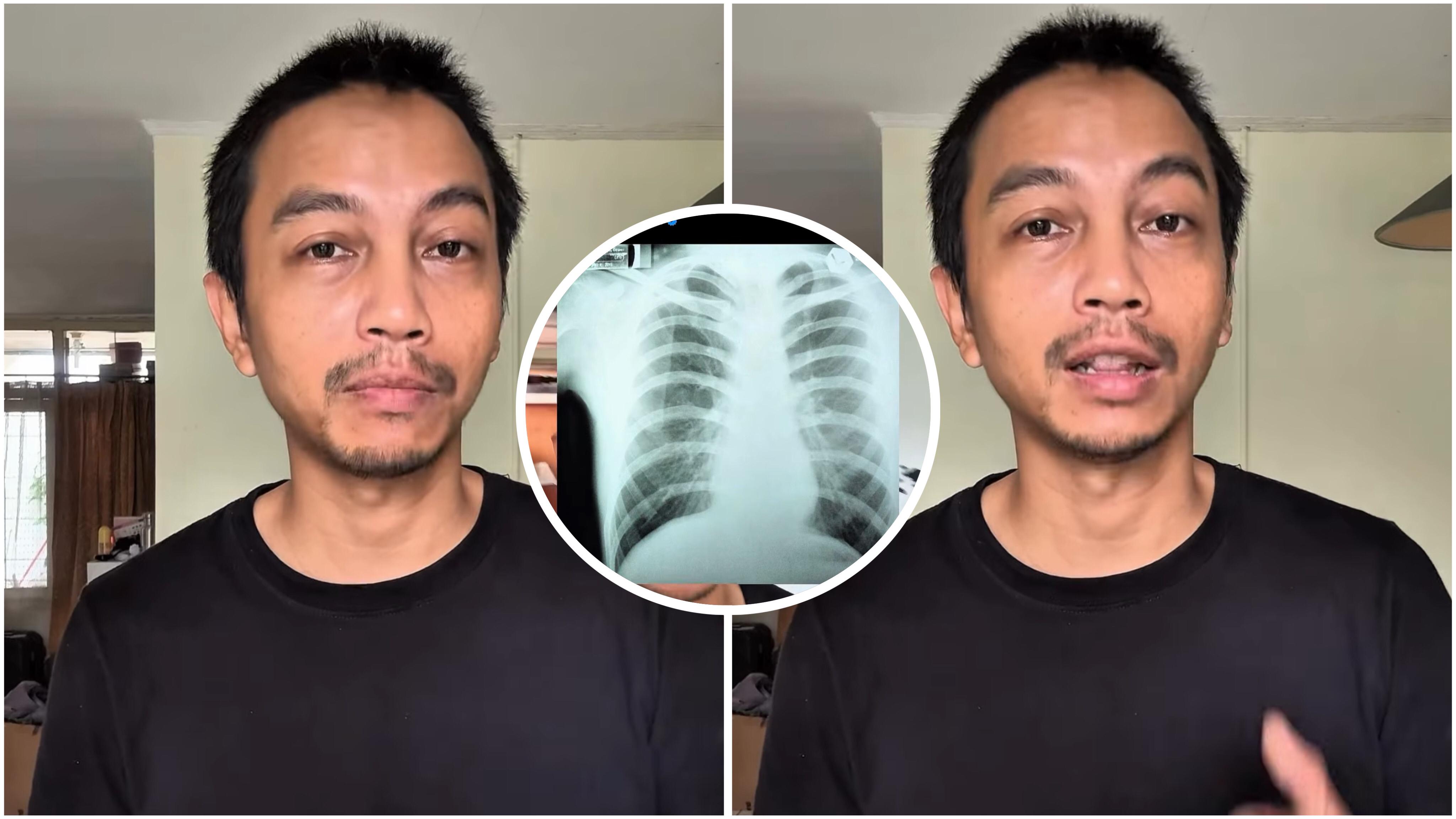 Perjuangan Fiersa Besari Berhenti Merokok 10 Tahun, Kematian Ayah dan Lahirnya Anak Jadi Pemicu 