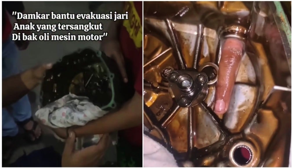 Viral! Bocah Main Servis Motor, Jari Nyangkut di Blok Mesin Endingnya Minta Tolong Damkar