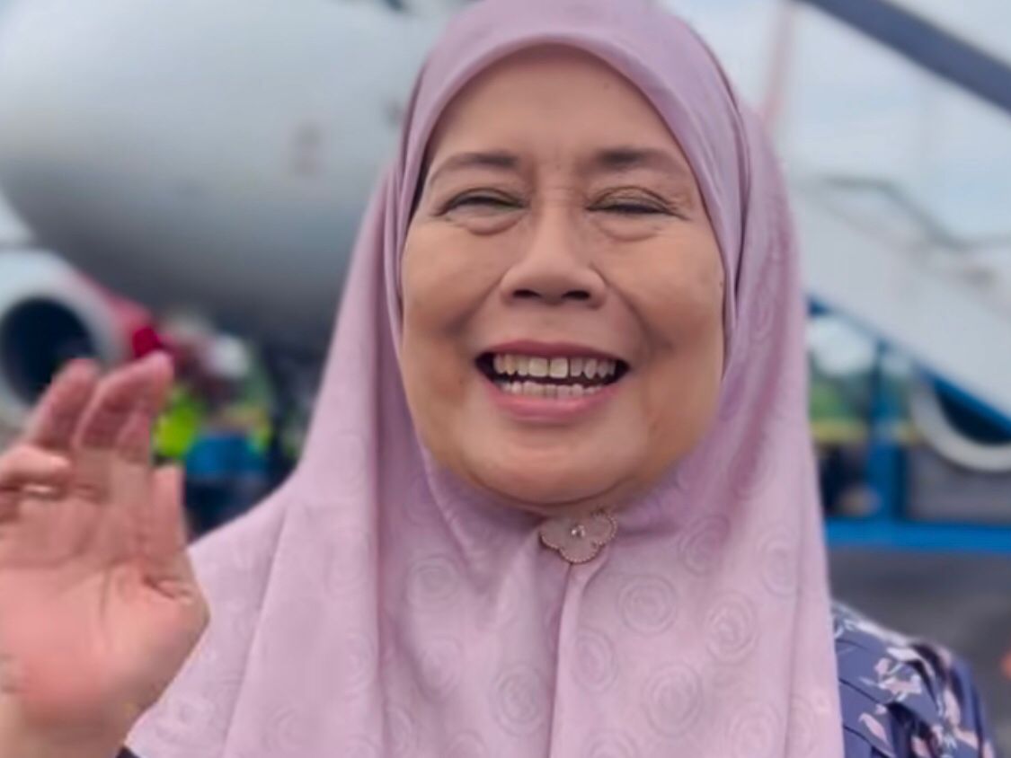 Kronologi Lengkap Mata Kanan Dewi Yull Buta, Penyebabnya Terungkap!