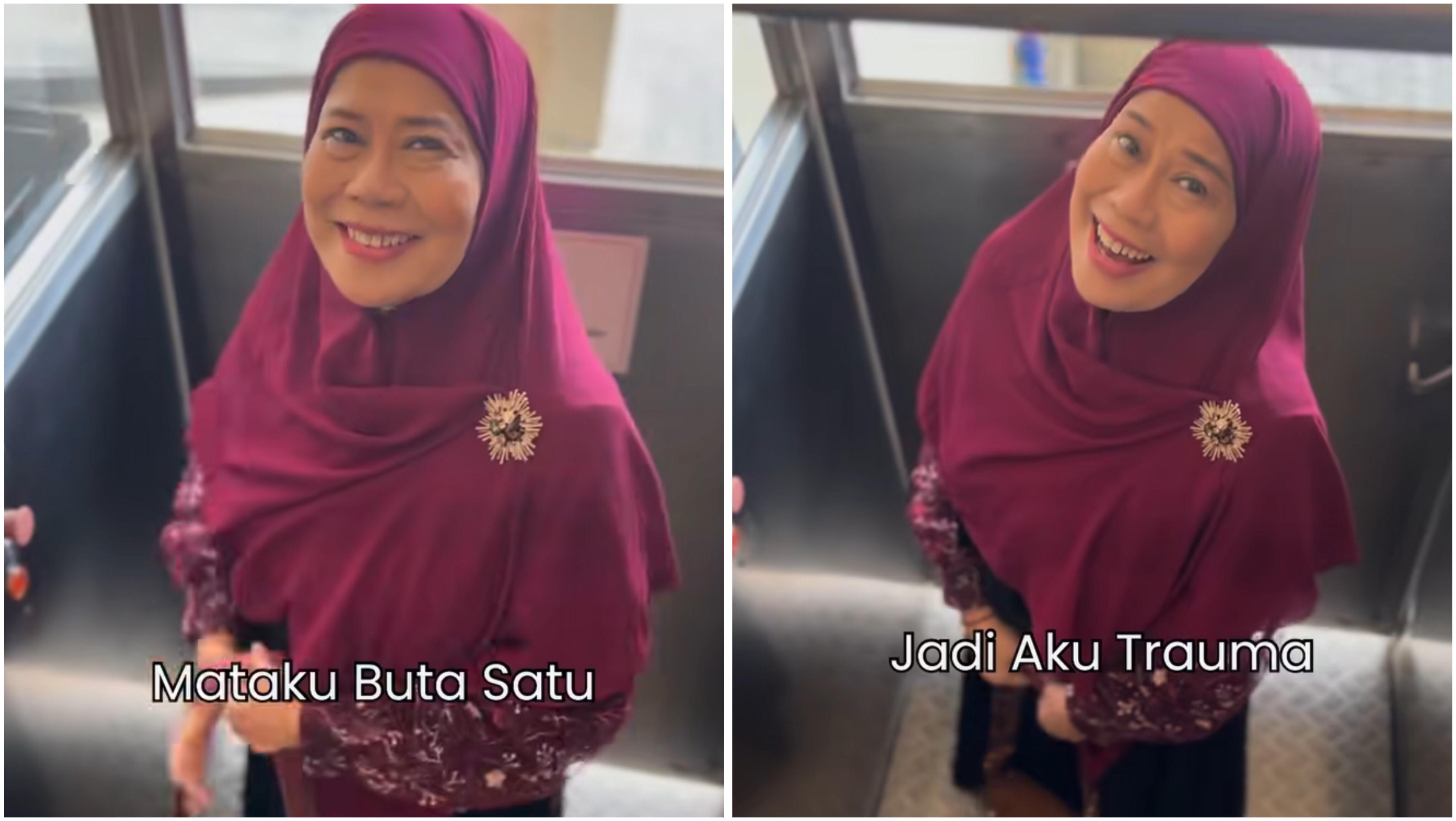 Dewi Yull Alami Buta Mata Kanan: Aku Disabilitas