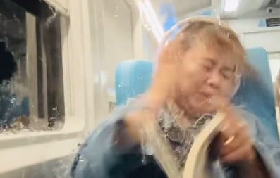 Wajah Terluka akibat Lemparan Batu di Kereta, Widya Imbau Penumpang KA Gorden Tutup agar Aman