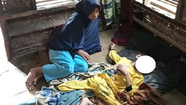 Kisah Pilu Bocah di Lebak Stunting Berat karena Keterbatasan Ekonomi, Kondisinya Mengenaskan