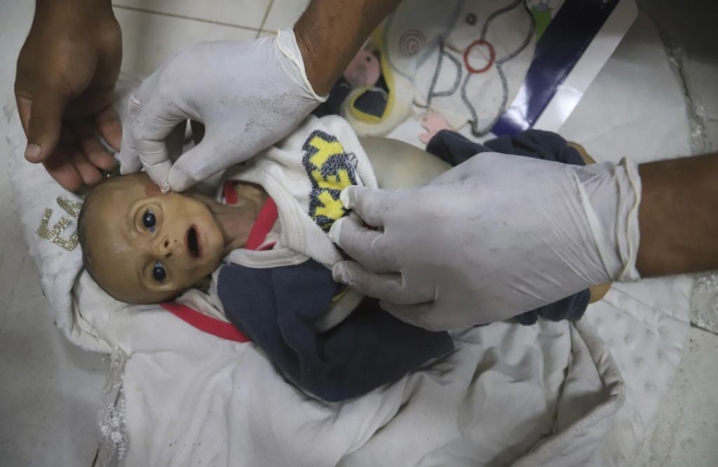 10 Persen Warga Gaza Kelaparan Akut, WHO Nyatakan Situasi Darurat Gizi