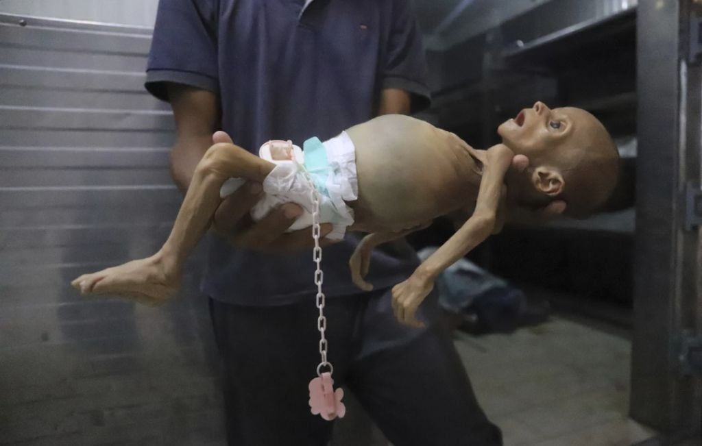 WHO: Kematian di Gaza akibat Kelaparan Mencapai Puncaknya