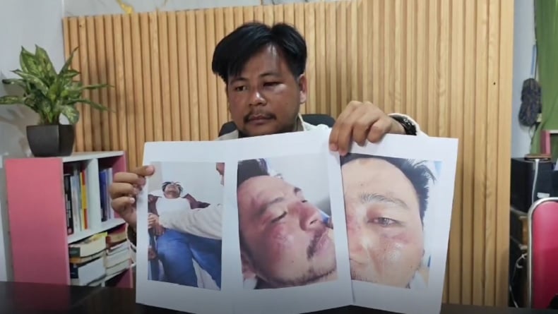Dikeroyok Preman dan Aparat saat Demo Pati, Kuasa Hukum Warga: Saya Diinjak Ditendang