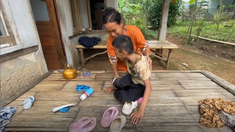 Kisah Pilu Bocah 10 Tahun di Lebak Lumpuh Layu sejak Bayi, Tak Ada Biaya untuk Berobat