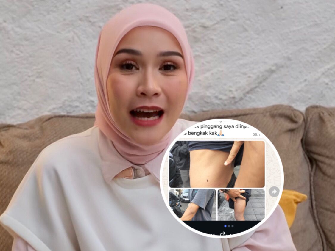 Viral ART Zaskia Adya Mecca Dianiaya Pria Mengaku Anggota, Leher dan Kepala Diinjak!