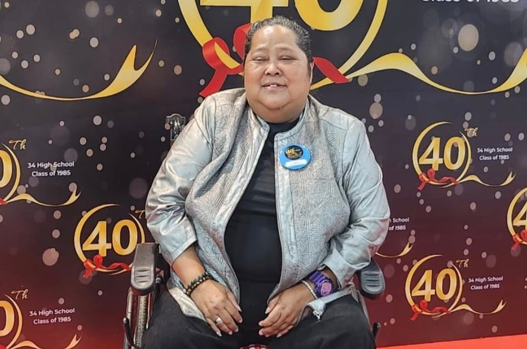 Suty Karno Sering Lupa Kakinya Sudah Dimputasi: Apa yang Mau Dipegang
