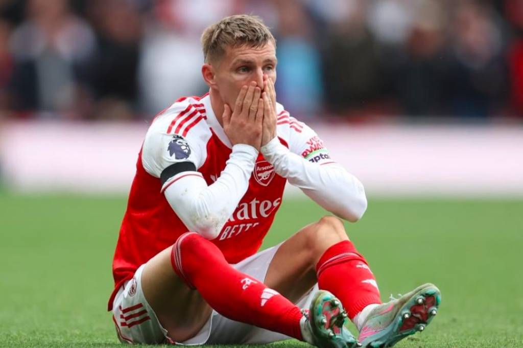 Martin Odegaard Cedera Lagi, Mikel Arteta Pusing jelang Arsenal Lawan Fulham