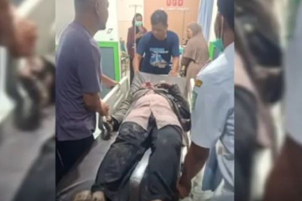 Tragedi Erupsi Gunung Semeru, Pasutri Luka Bakar Kena Awan Panas di Gladak Perak