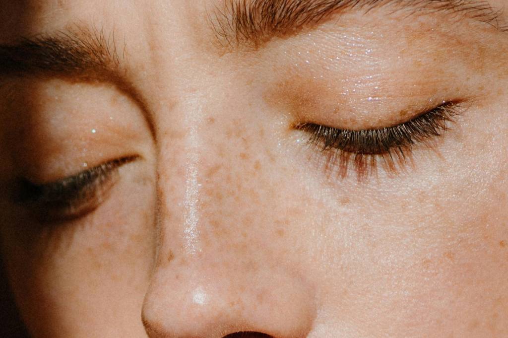 Tips Menghilangkan Flek Hitam Secara Alami, Dokter Ungkap Manfaat Bahan Herbal yang Aman di Rumah