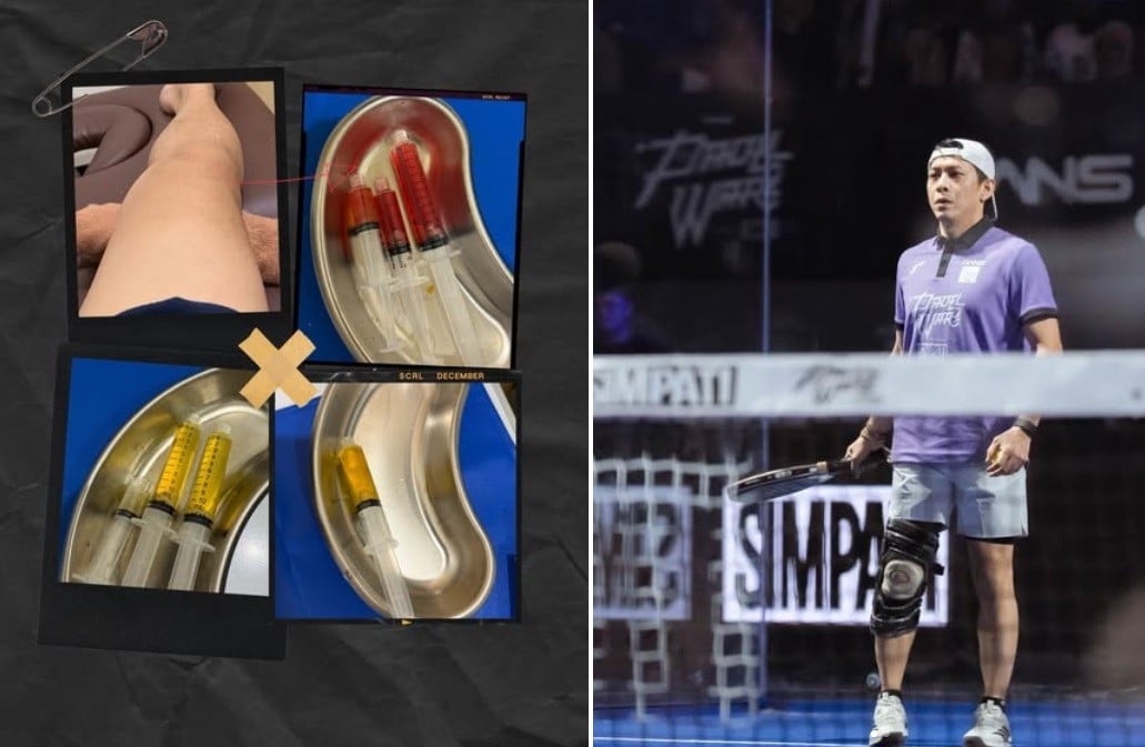 Ariel Noah Alami Cedera Serius di Lutut, Kenapa?