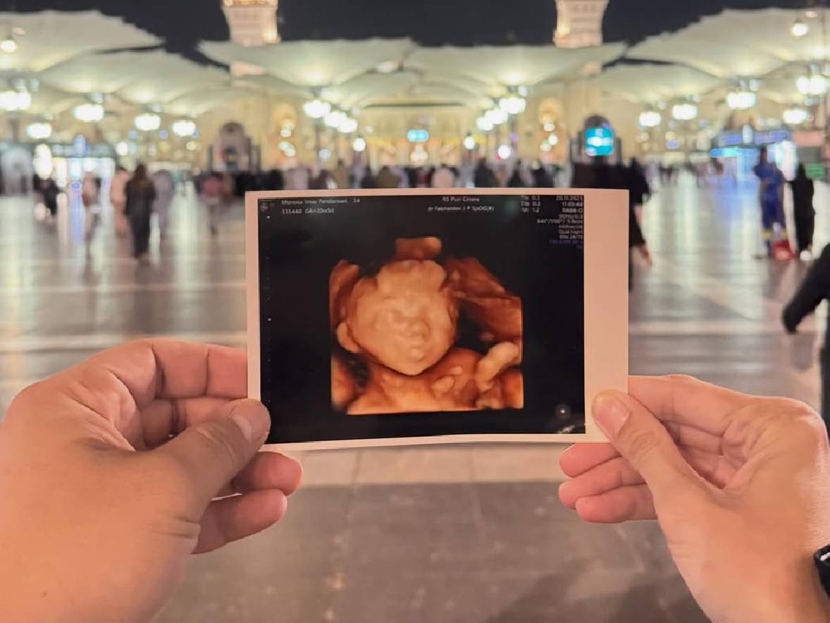 Innalillahi, Anak ke-4 Rizal Armada Meninggal Dunia dalam Kandungan