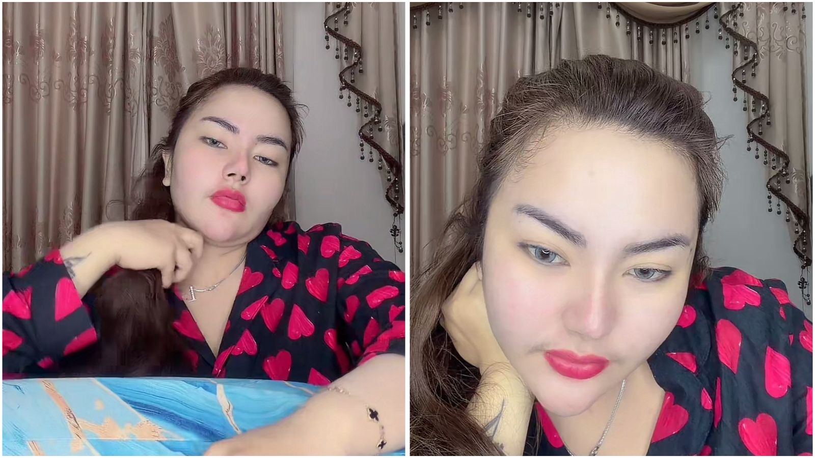 Kronologi Lengkap Lisa Mariana dan Keluarga Keracunan Kepiting Alaska, Kondisinya Parah!