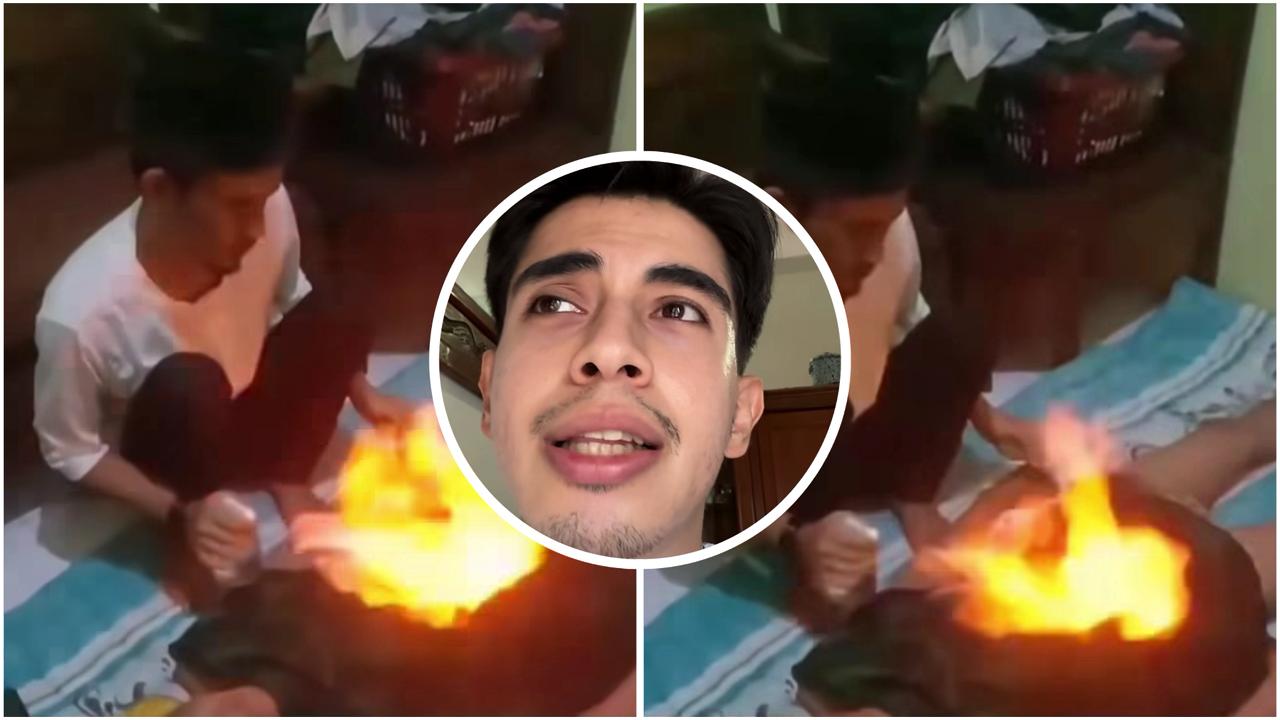 Viral Cara Obati GERD dengan Bakar Perut, Ini Kata Dokter!