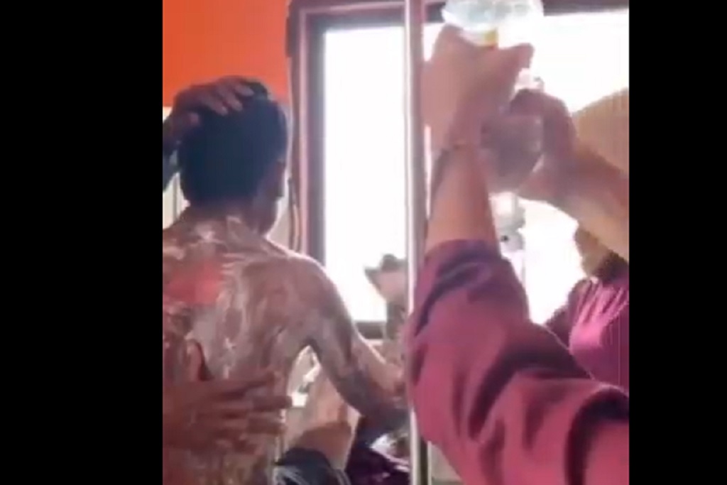 Tolak Cari Rumput, Pemuda di Sumbawa NTB Dibakar Ibu Kandung