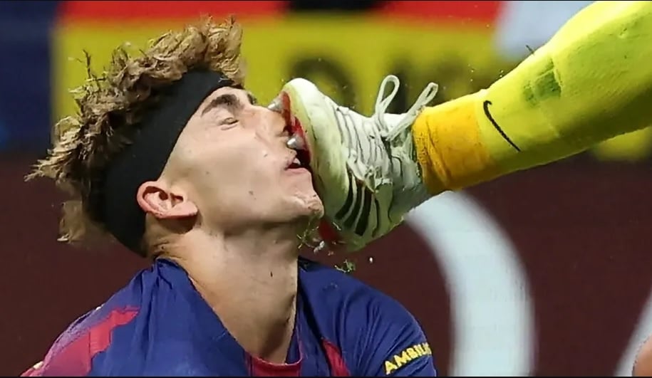 Horor! Fermin Lopez Berdarah-Darah Usai Kena Tendangan Kiper Atletico