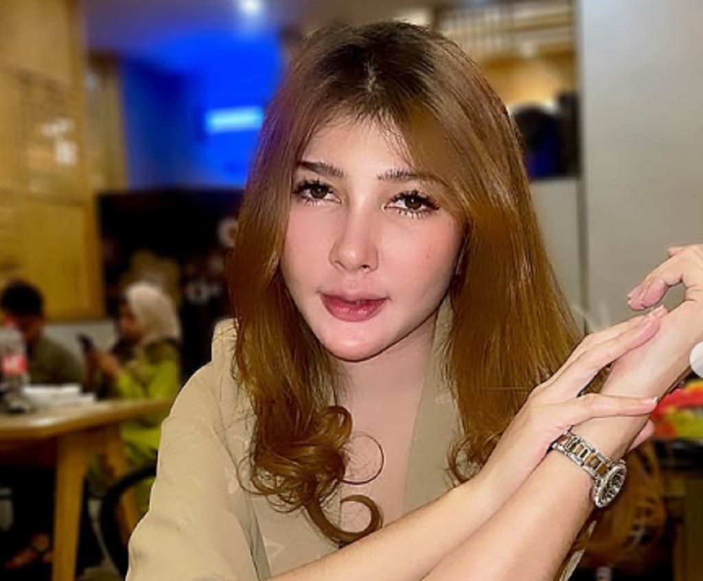 Ngeri! 15 Korban Facelift Ilegal Eks Finalis Puteri Indonesia Cacat Permanen