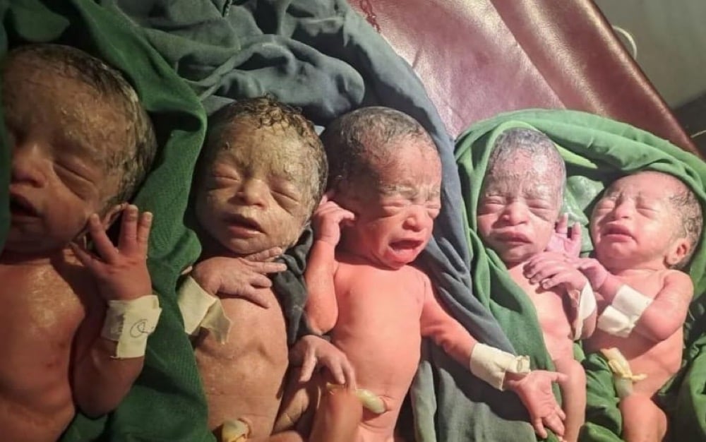 12 Tahun Nantikan Anak, Perempuan Ini Lahirkan Bayi Kembar 5