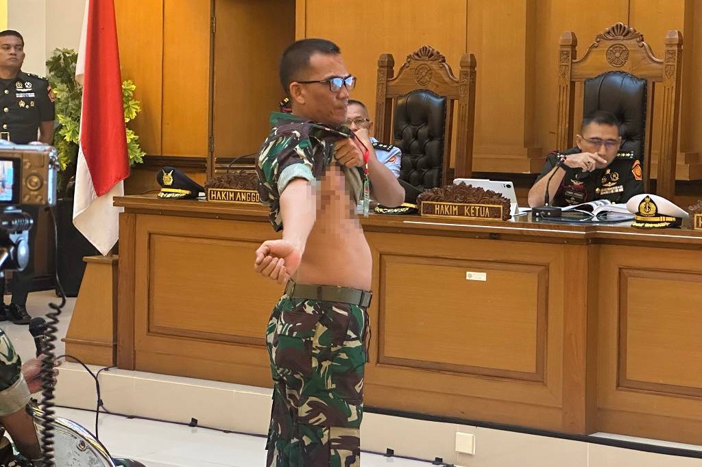 Prajurit TNI Tunjukkan Bekas Luka usai Terciprat saat Siram Air Keras ke Andrie Yunus