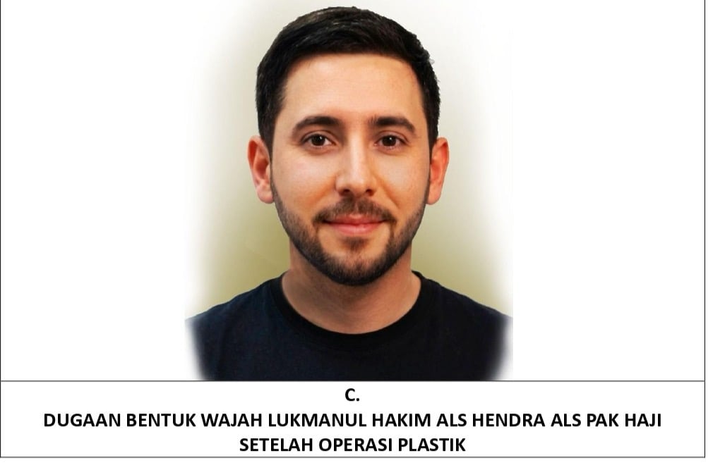 Buron Bandar Narkoba Jaringan The Doctor Diduga Operasi Plastik