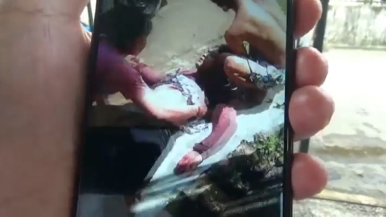 Korban penusukan Korban Rio usai ditusuk tetangganya (Guntur/iNews)