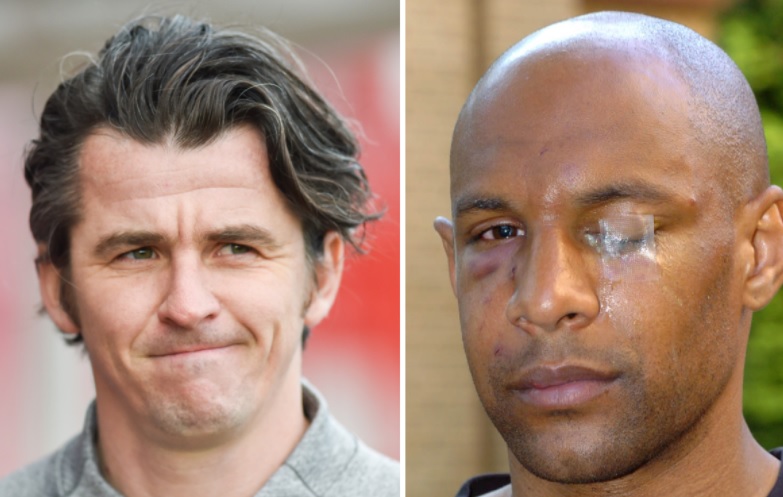 Joey Barton Foto: The Sun