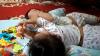 Orang Tua Bayi Kembar Siam Akila dan Azila Pasrah Jelang Operasi Pemisahan