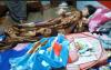 Viral, Ibu di Tasikmalaya Mendadak Hamil Hanya 1 Jam