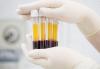Donor Plasma Darah Golongan AB Paling Sulit Dicari
