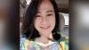 Lewati Masa Kritis, Kondisi Perawat Cantik Korban Pembakaran Mulai Membaik