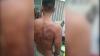Viral Narapidana di Tanjung Gusta Luka Lebam, Diduga Dianiaya Sipir