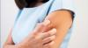 Ini Penyebab Penyakit Herpes, Gejala dan Cara Mengobati, Waspada Jika Area Genital Anda sering Luka 
