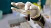  Antisipasi Hepatitis Akut, Sleman Aktifkan Tim Surveilans 
