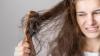 Bahan Alami Atasi Rambut Rontok, Simak Cara Penggunaannya