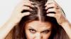 Atasi Ketombe di Rambut Kepala, 3 Cara Berikut Bisa Dicoba