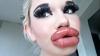 Duh, Perempuan Ini Bangga Punya Bibir Terbesar di Dunia hasil Suntikan