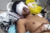  Warga Mestong Jambi Luka Parah Diserang Beruang saat Berada di Kebun