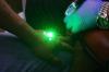Hapus Tato Gratis dengan Laser - Bagian 1