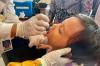 Antusiasme Anak-Anak Ikuti Imunisasi Polio di Desa Pasir Barat Tangerang - Bagian 2