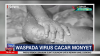 Virus Mpox Meningkat, Sandiaga Uno Minta Wisatawan Cek Kesehatan di Bandara