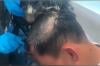 Pria Ini Pakai Rambut Palsu Berisi 19 Kapsul Kokain - Bagian 2